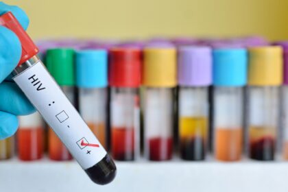 gruodžio -1 ąja, pažymima Pasaulinė AIDS diena. Šių metų šūkis "Mano sveikata, mano teisė".