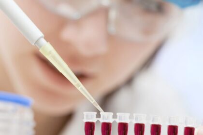 Nacionalinio visuomenės sveikatos centro prie Sveikatos apsaugos ministerijos Panevėžio departamentas (NVSC Panevėžio departamentas) informuoja, kad daugėja naujų ŽIV infekcijos atvejų.