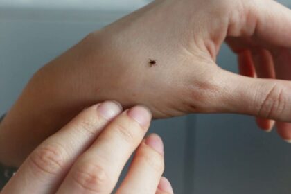 Nacionalinio visuomenės sveikatos centro prie Sveikatos apsaugos ministerijos Panevėžio departamentas (NVSC Panevėžio departamentas) informuoja, kad Panevėžio regione šiais metais sausio - gegužės mėn. užregistruota 60 Laimo ligos atvejų.