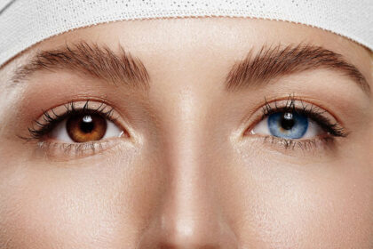 Visiems be išimties ne kartą teko matyti gyvūną – šunį ar katę – skirtingų spalvų akimis. Tačiau nereikėtų nustebti išvydus ir tokį unikalų žmogų.