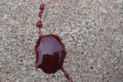 Po nakties daugiabutyje – kraujo klanas ir galimai peršautos durys