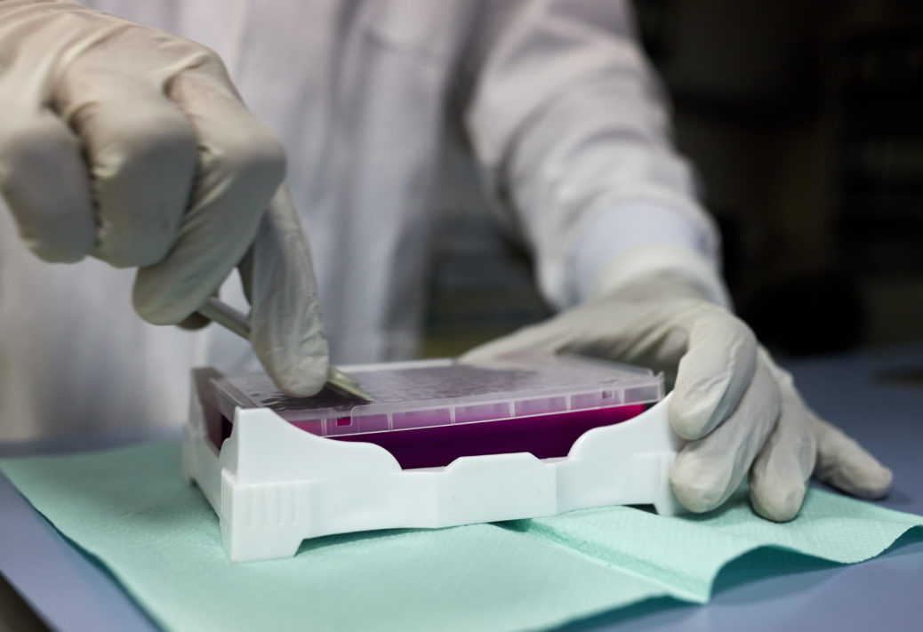 Sveikatos apsaugos ministerija penktadienį planuoja pasirašyti sutartį su viena iš Lietuvoje veikiančių įmonių, jog ši gamintų ir tiektų reikalingus testus koronavirusui nustatyti.