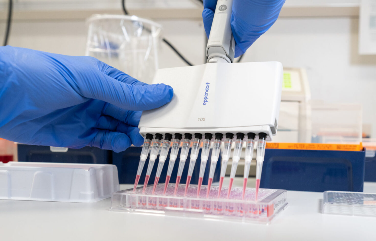 Lietuvoje patvirtinus 14 naujų koronaviruso atvejų, bendras jų skaičius šalyje pasiekė 1399, penktadienį pranešė Sveikatos apsaugos ministerija.