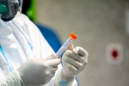 Koronavirusas patvirtintas antram Santaros klinikų medikui, paskelbė portalas LRT.lt.