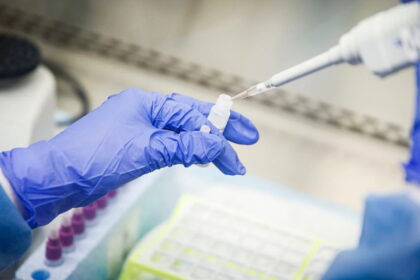 Tyrimai dėl koronaviruso nuo trečiadienio atliekami Santaros bei Kauno klinikose ir Respublikinėje Šiaulių bei Klaipėdos universitetinėje ligoninėse, pranešė Sveikatos apsaugos ministerija.