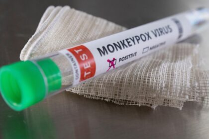 Sveikatos apsaugos viceministras Aurimas Pečkauskas teigia, kad dar nuo 1980 metų Lietuvoje skiepas nuo raupų turėtų būti efektyvus prieš plintančią beždžionių raupų atmainą.