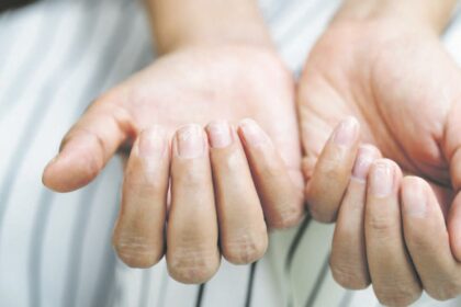 Visi žinome – nagai labai daug pasako apie mūsų sveikatą. Jeigu jie silpni, trapūs, nenatūralios spalvos ar rievėti, tai gali būti signalas, jog kažkas vyksta organizme.