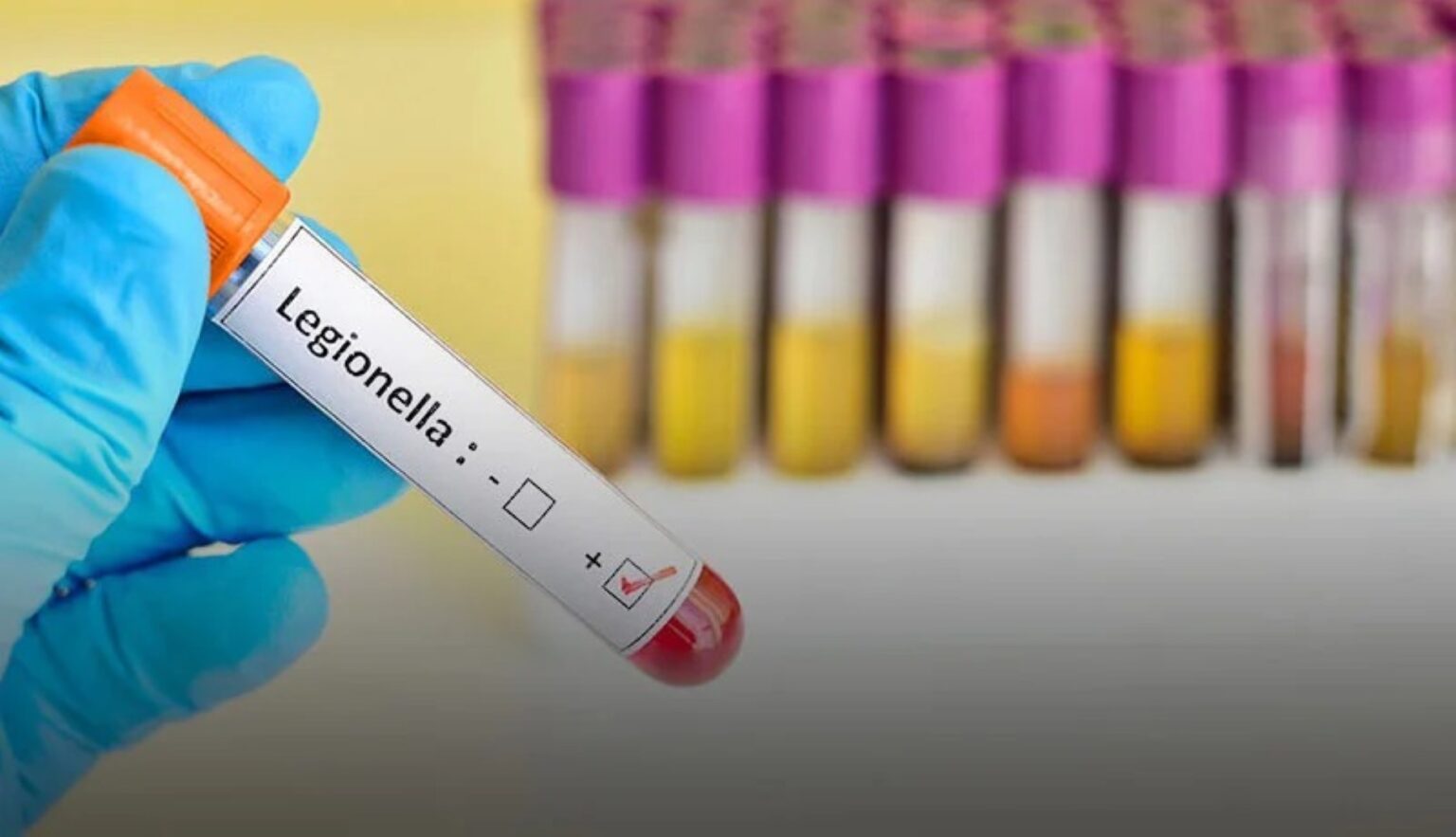 Lietuvoje per pirmąjį šių metų mėnesį iš viso užregistruoti penki legioneliozės atvejai, antradienį pranešė Nacionalinis visuomenės sveikatos centras (NVSC).