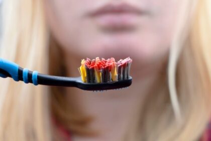 Yra daugybė priežasčių, dėl kurių gali kraujuoti ar skaudėti dantenos, pradedant nuo pernelyg didelio mūsų pačių entuziazmo valantis dantis ir tarpdančius.